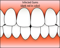 Dentists who treat gingivitis manassas