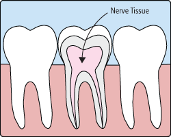 Dental Root Canals Dentists Manassas VA